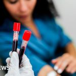 Galleri test: Exciting results from blood test for 50 cancers
