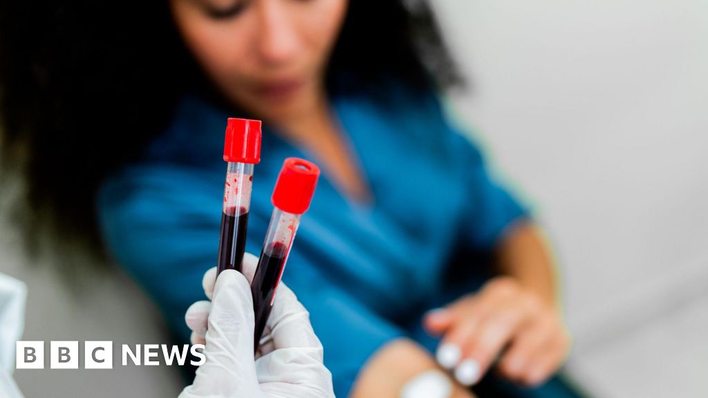 Galleri test: Exciting results from blood test for 50 cancers