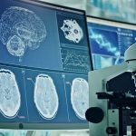 Why it is high time young Indians under 40 need to know about stroke symptoms