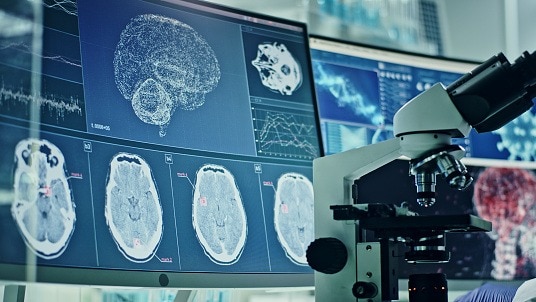 Why it is high time young Indians under 40 need to know about stroke symptoms